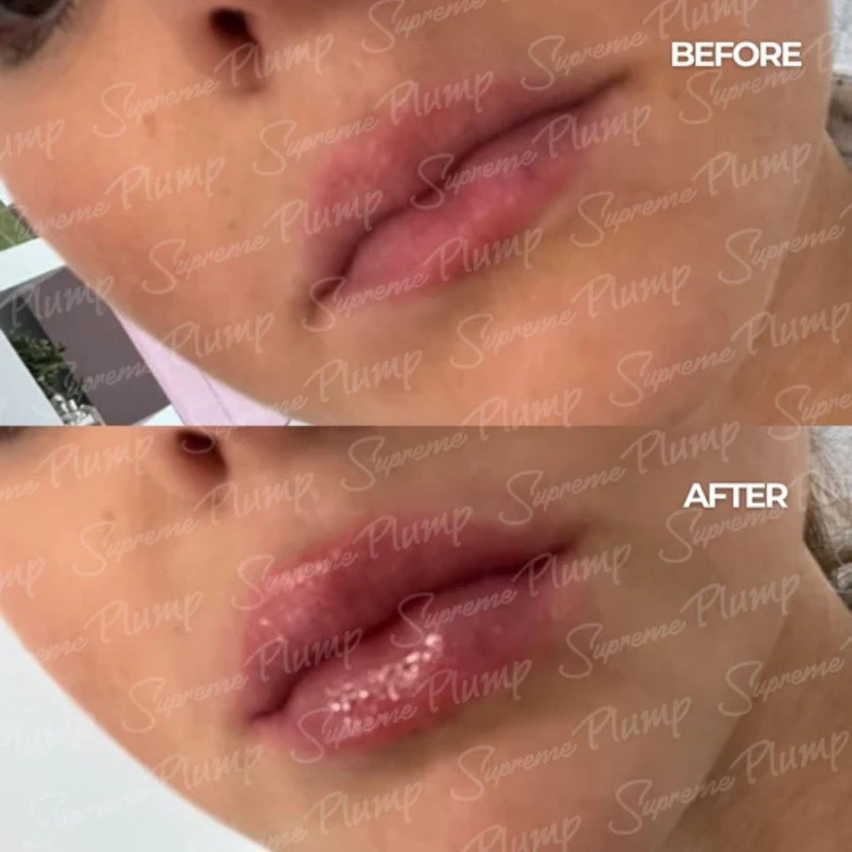 Ultimate Lip Plumper Boost